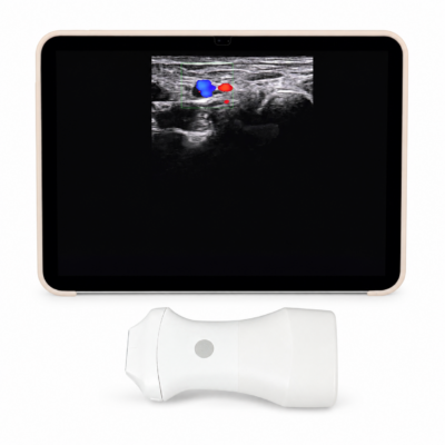 Wireless Probe Ultrasound Scanner