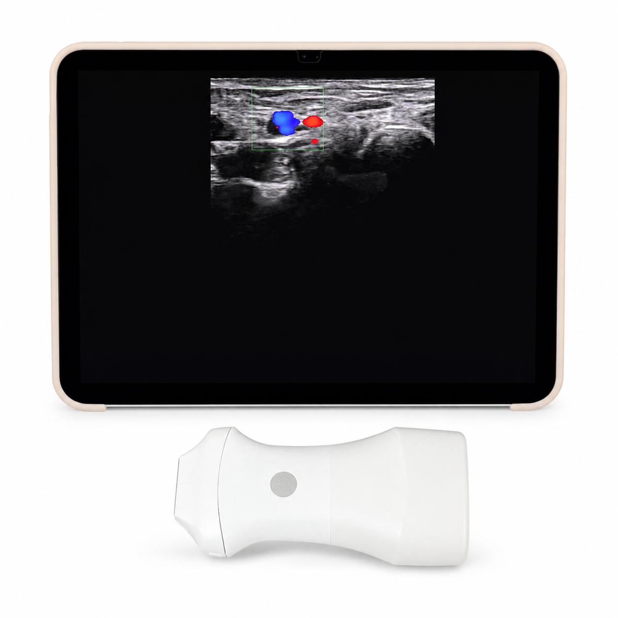Wireless Probe Ultrasound Scanner
